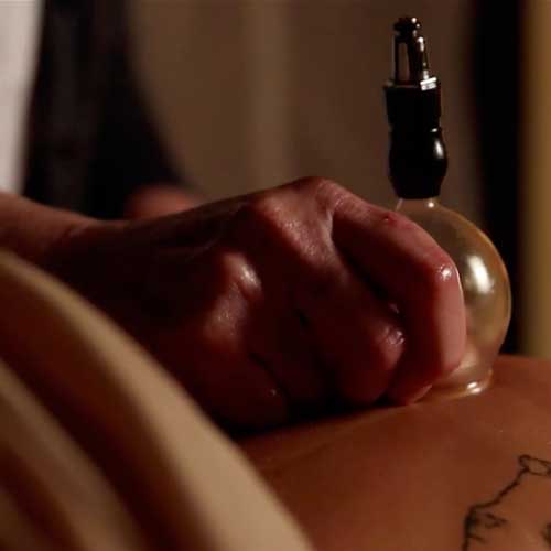 Acupuncture